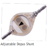 Adjustable Depus Shunt